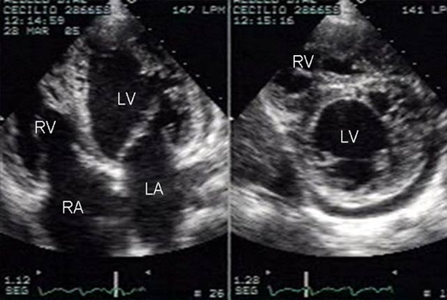 Point of Care Ultrasound (POCUS)